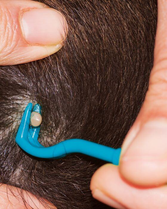 maladie de lyme chien - tique en train d'être enlevée